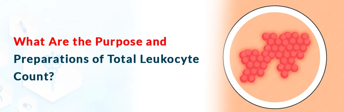  What Are the Purpose and Preparations of Total Leukocyte Count?